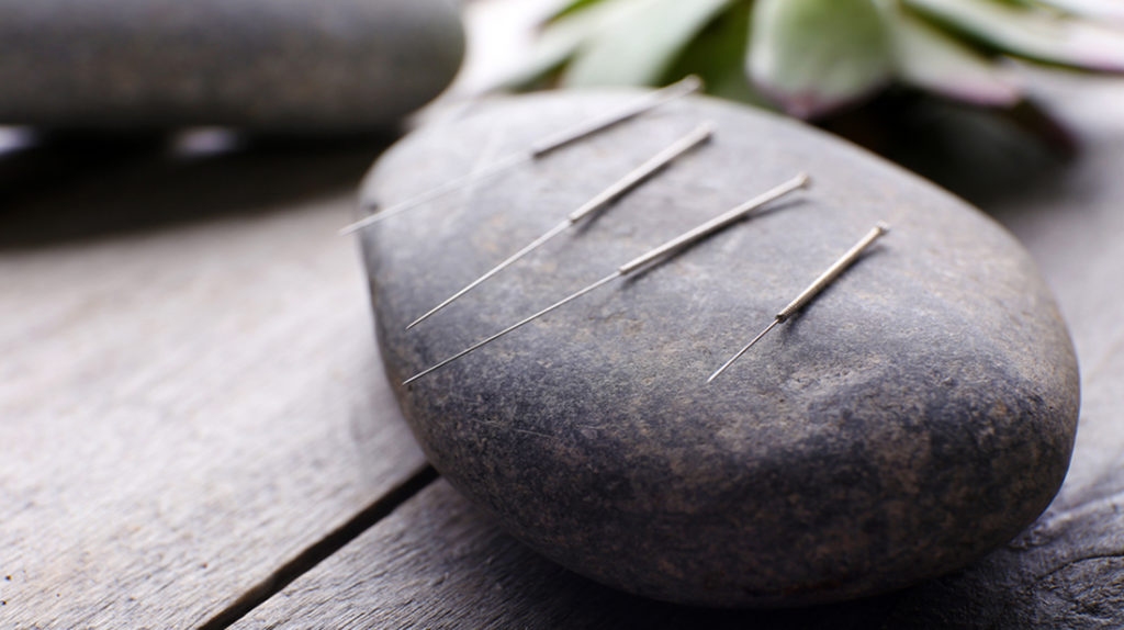 Acupuncture Tarpon Springs | White Crane Clinic