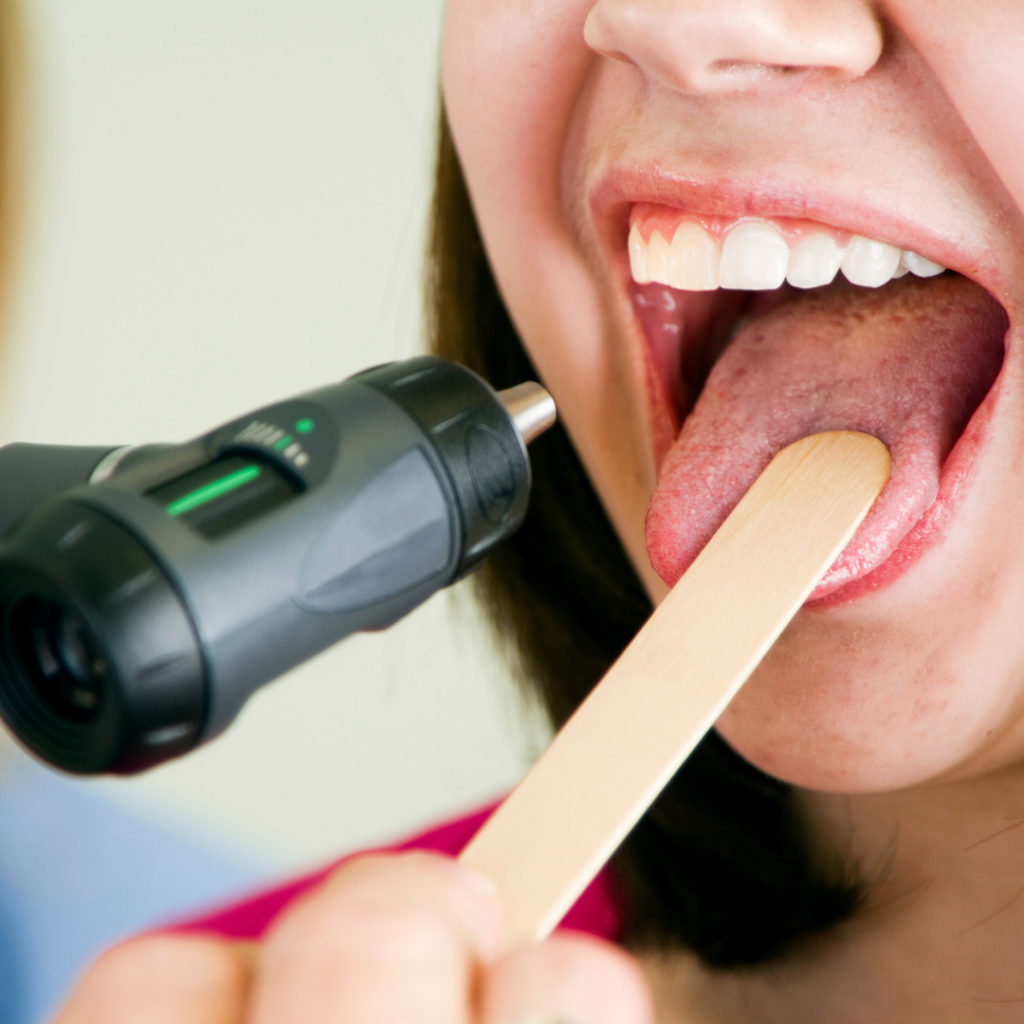 why-does-my-acupuncturist-look-at-my-tongue