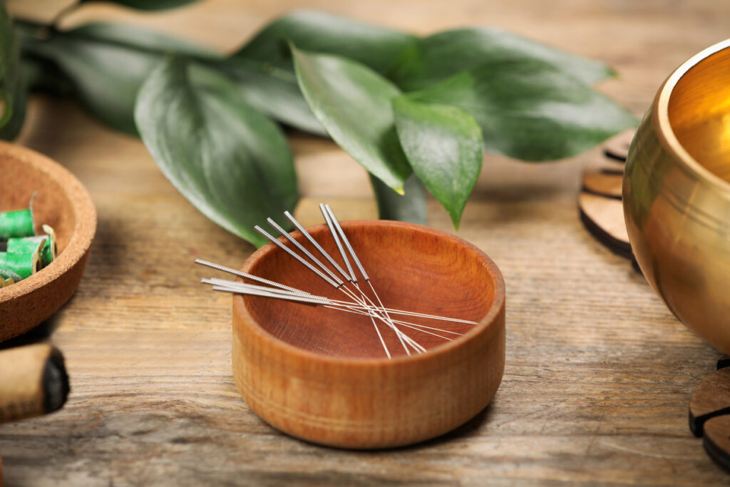 how does acupuncture work