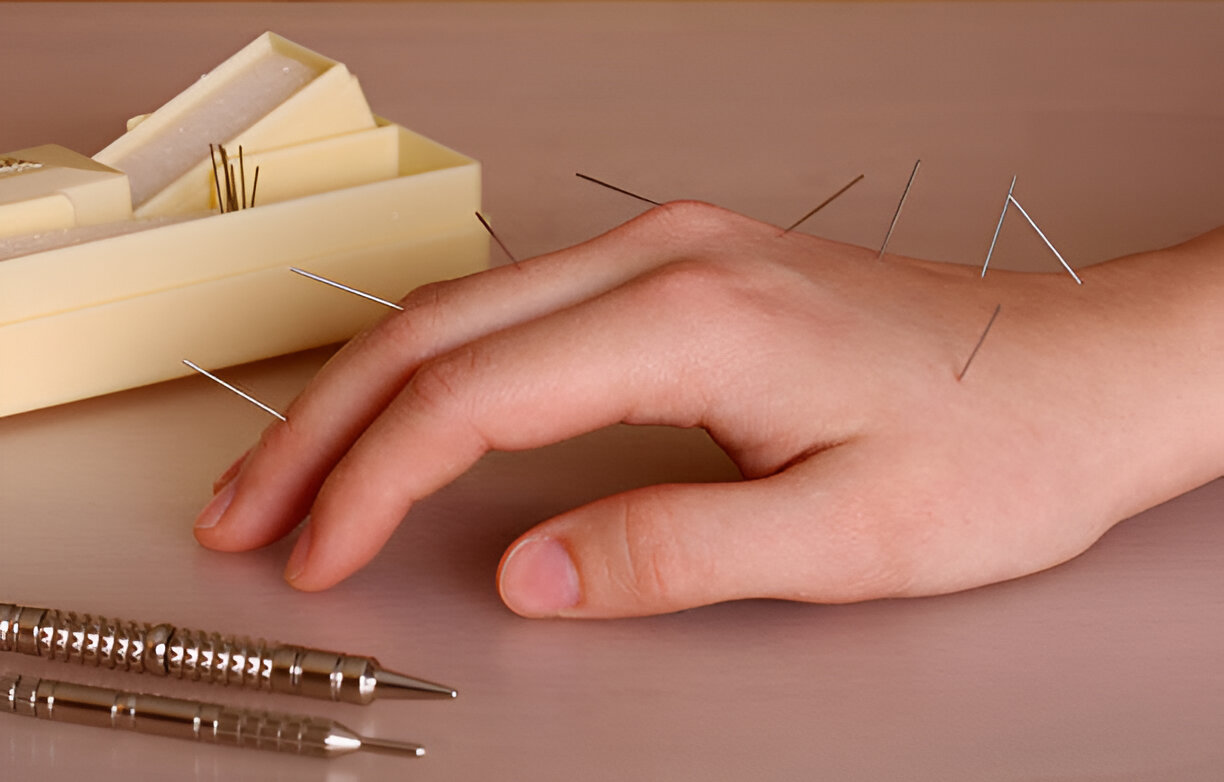 Acupuncture Techniques 2, White Crane Clinic