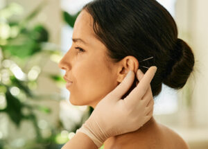 Acupuncture for Insomnia